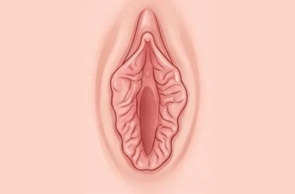 과대주름 소음순 그림