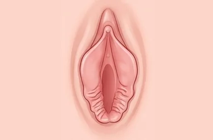 하단주름 소음순 그림